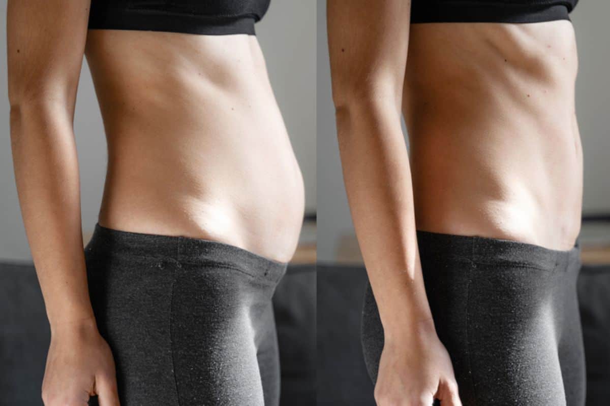 Post-Pregnancy: What Happens to Your Abdominal Muscles After Birth Wrexham