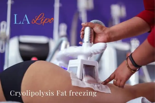 women getting fat freezing Wrexham