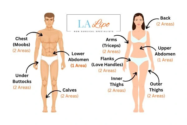 LA LIPO Cryolipolysis Areas Wrexham