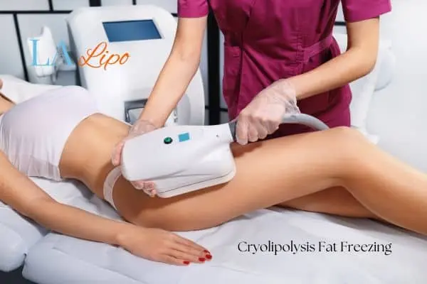Woman receiving coolsculpting Wrexham treatment on her thighs