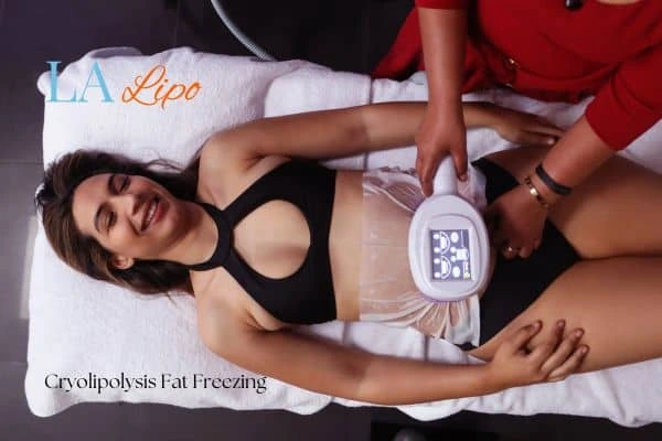 woman getting cryolipolysis Wrexham