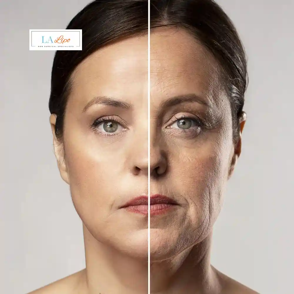 How Can You Tell If Non-Surgical Skin Tightening Is Right for You Wrexham?