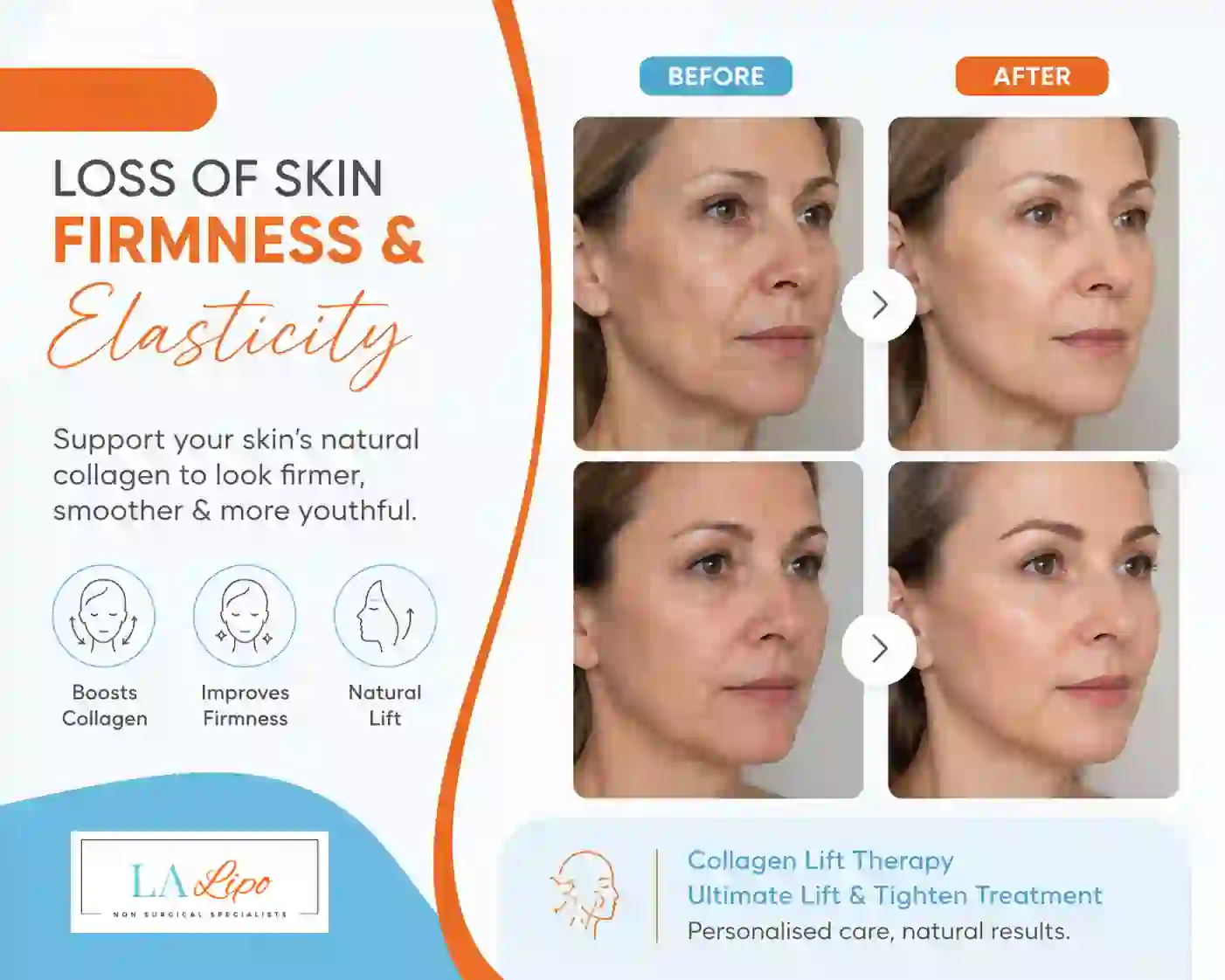 Sign #7: Loss of Skin Firmness and Elasticity Wrexham