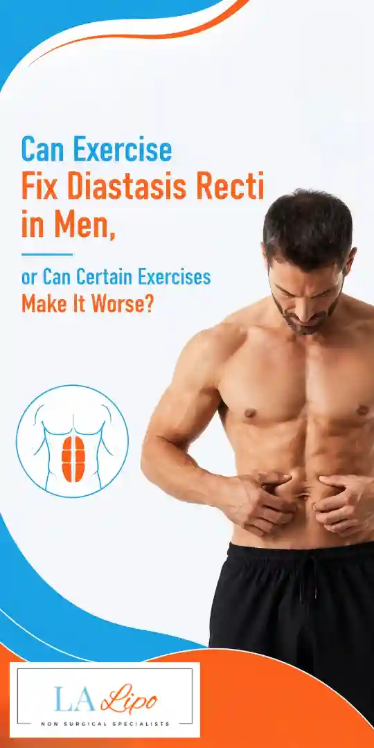 Can Exercise Fix Diastasis Recti in Men, or Can Certain Exercises Make It Worse Wrexham?